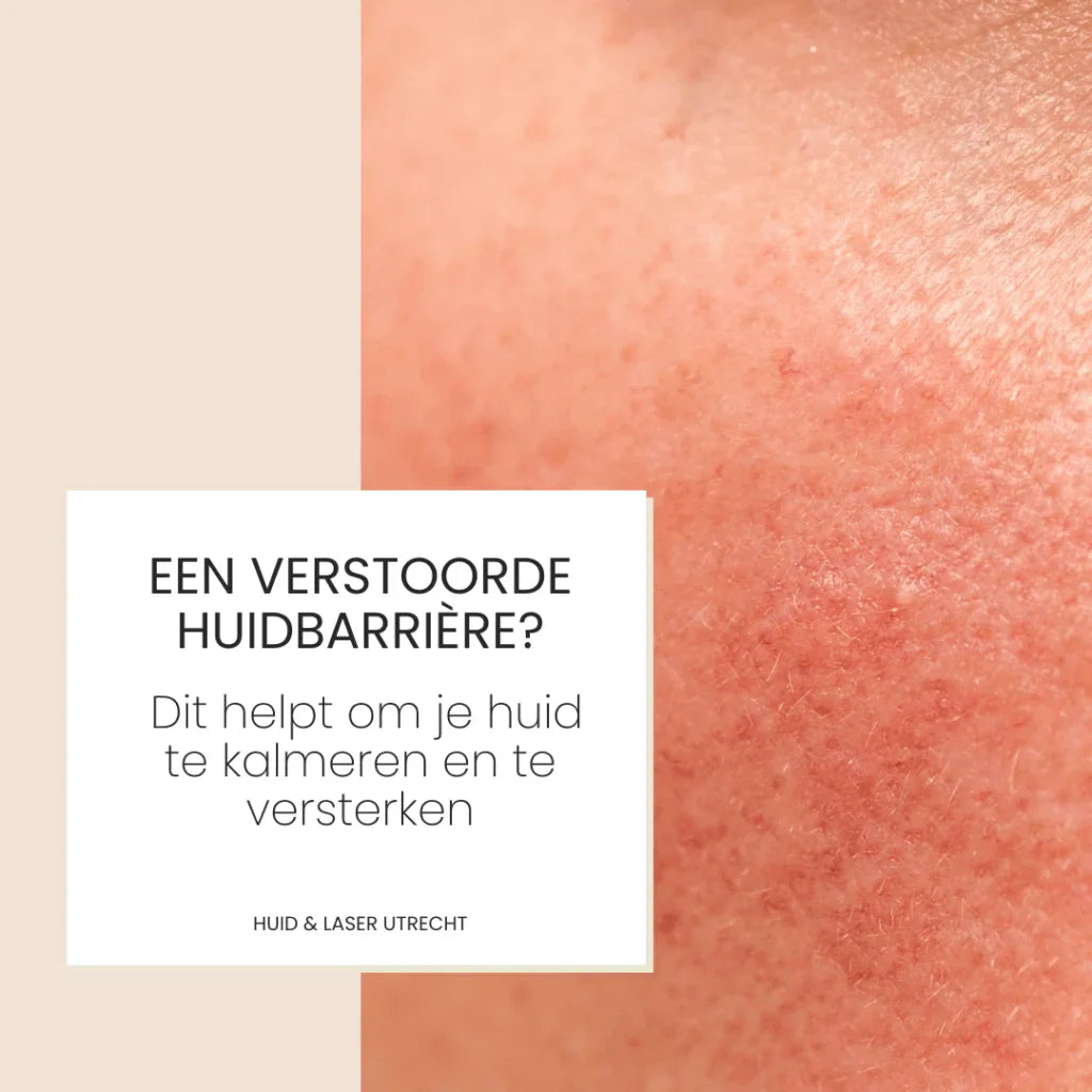 Een verstoorde huidbarrière? Dit helpt om je huid te kalmeren en versterken