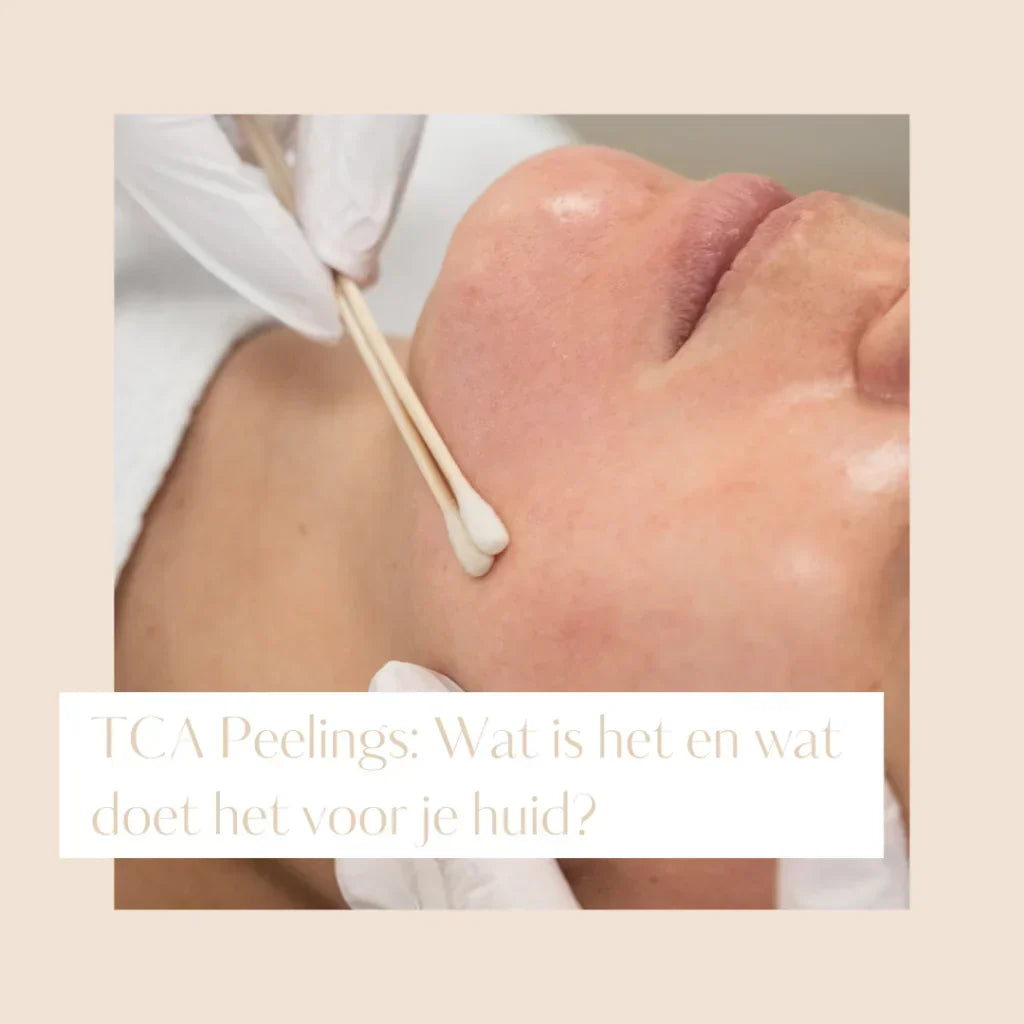 TCA Peeling: Wat is het en wat doet het voor je huid?