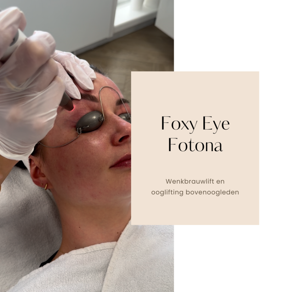 Vectorlift Foxy Eye behandeling, Vervanging ooglidcorrectie?