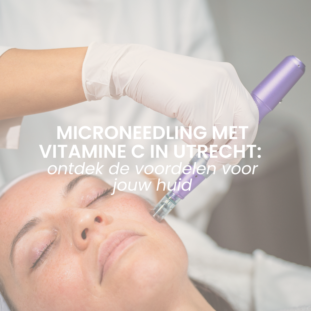 Microneedling met vitamine C in Utrecht: ontdek de voordelen voor jouw huid