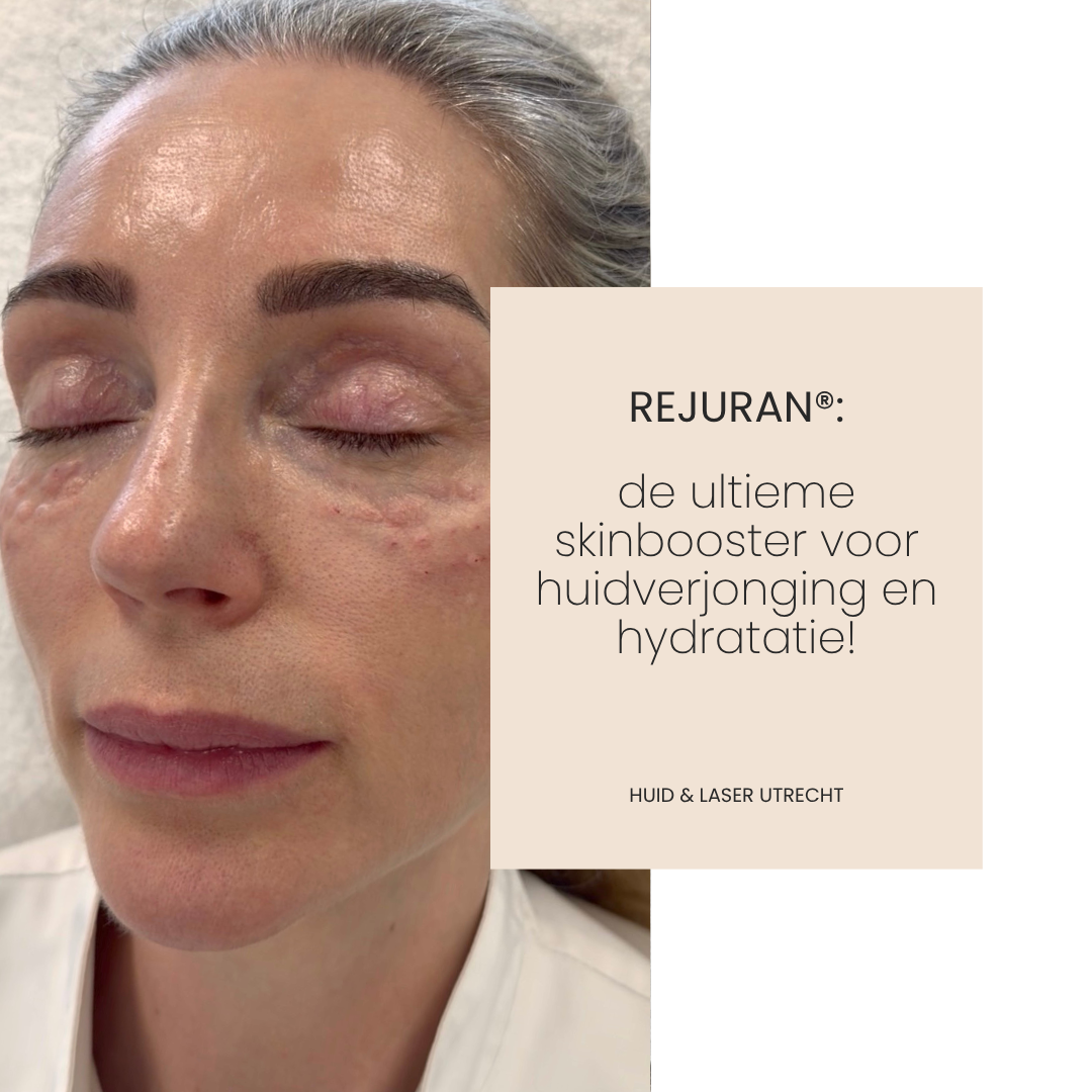 Rejuran®: de ultieme skinbooster voor huidverjonging en hydratatie onder de ogen!