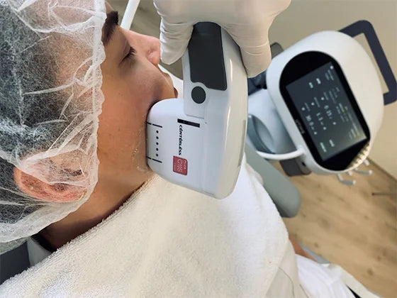 Huid & Laser Utrecht boekt goede resultaten met HIFU!