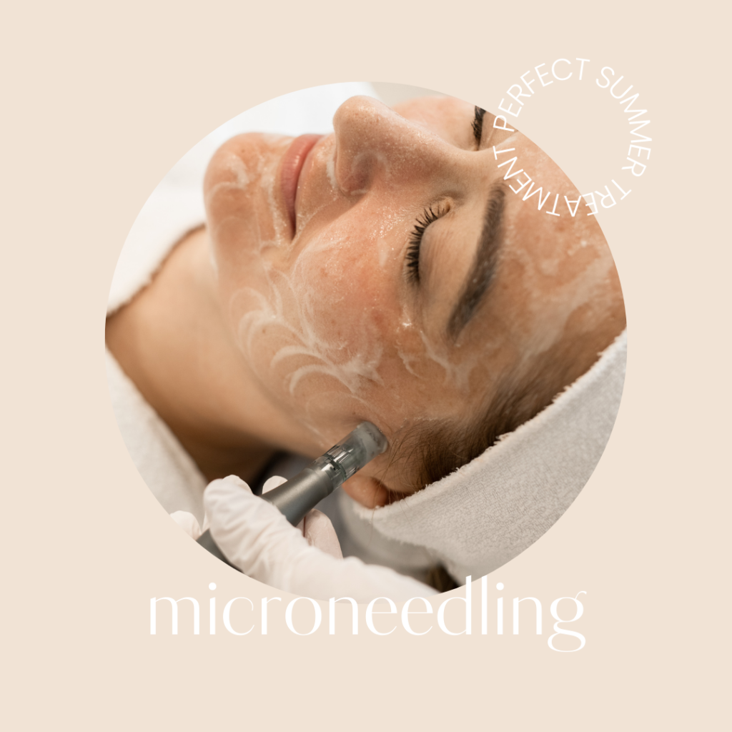 Microneedling en peelings veilig in de zomer?