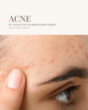E-book Acne