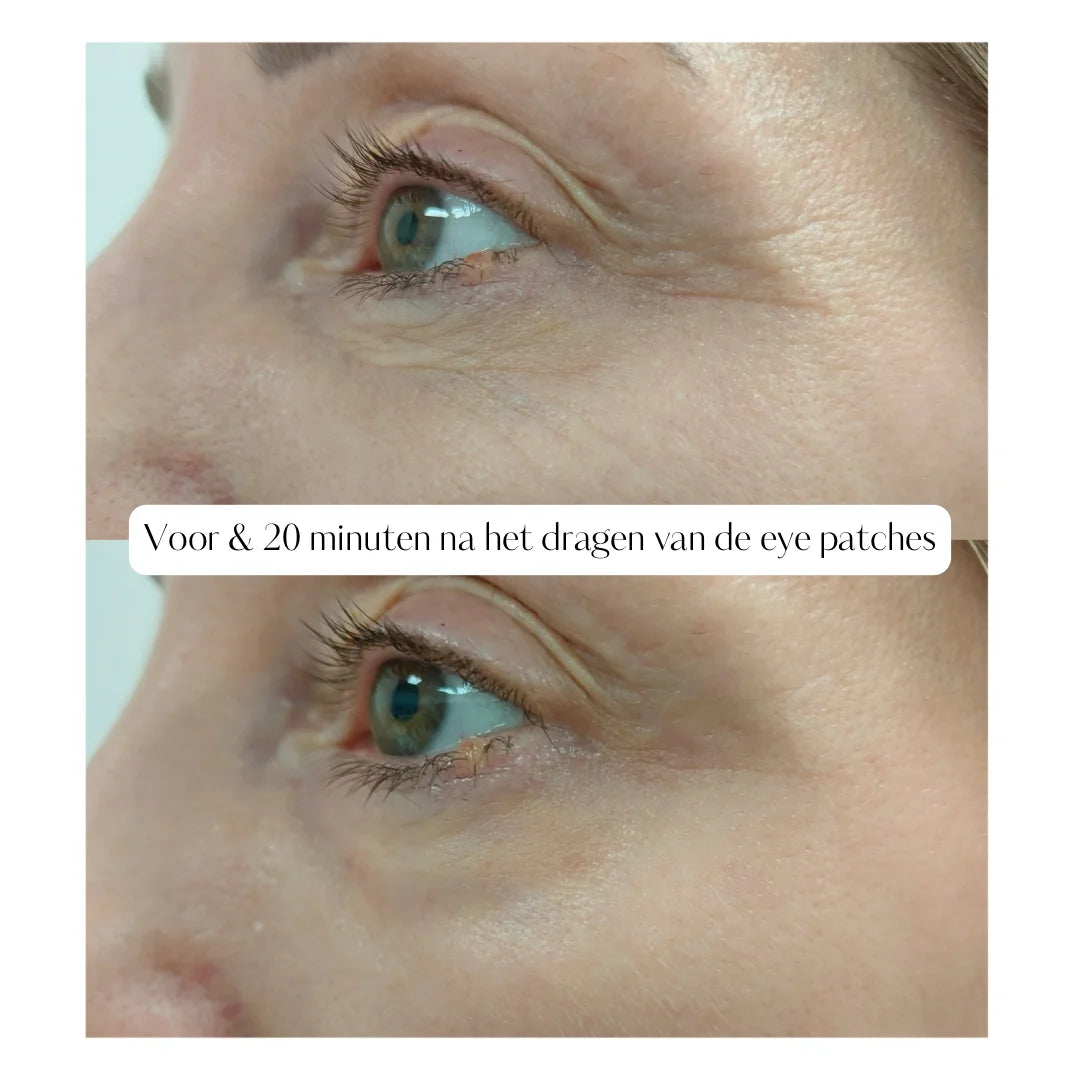 I’M Emmagen Firm & Glow Hydrogel Eye Patches